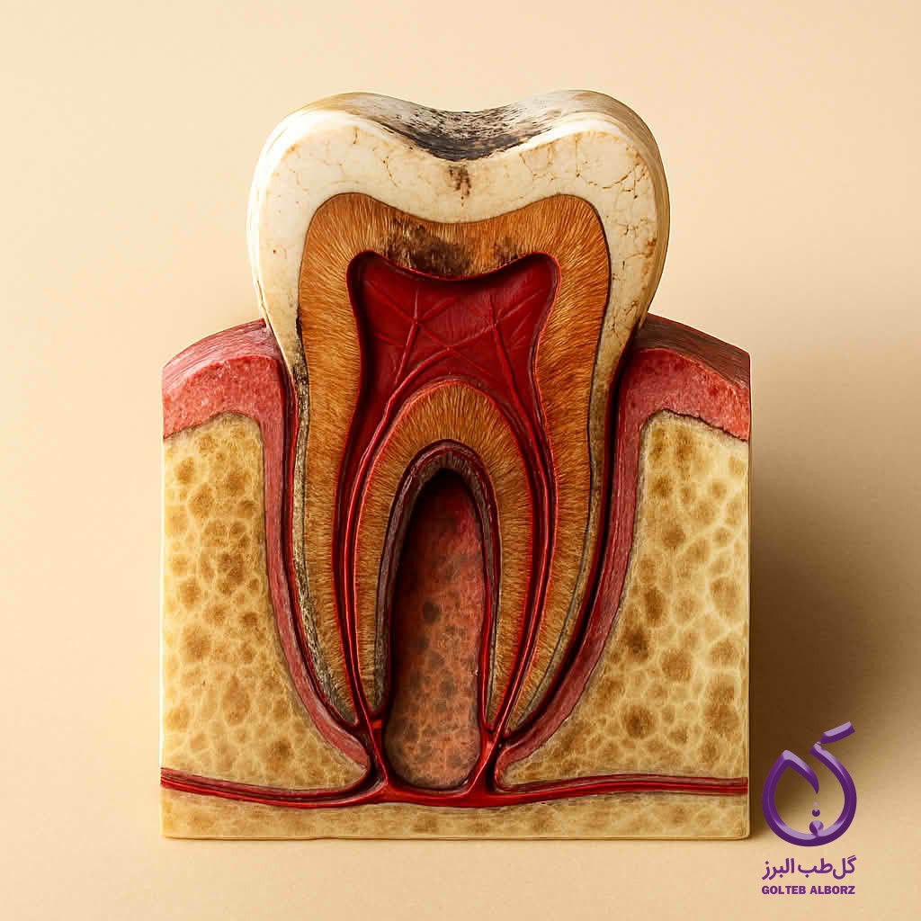 damaged tooth with root and enamel defects