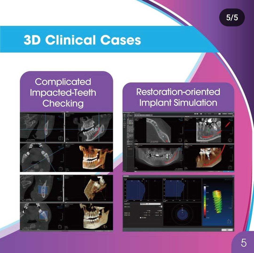 Bundent company's free webinar for CBCT scanner