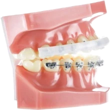 Ortho Lip Protector - IOS
